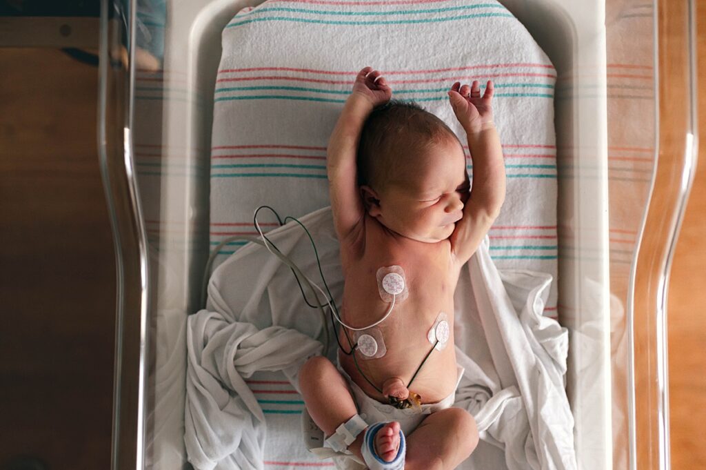 A newborn is photographed during a fresh 48 newborn photoshoot at a Houston hospital NICU