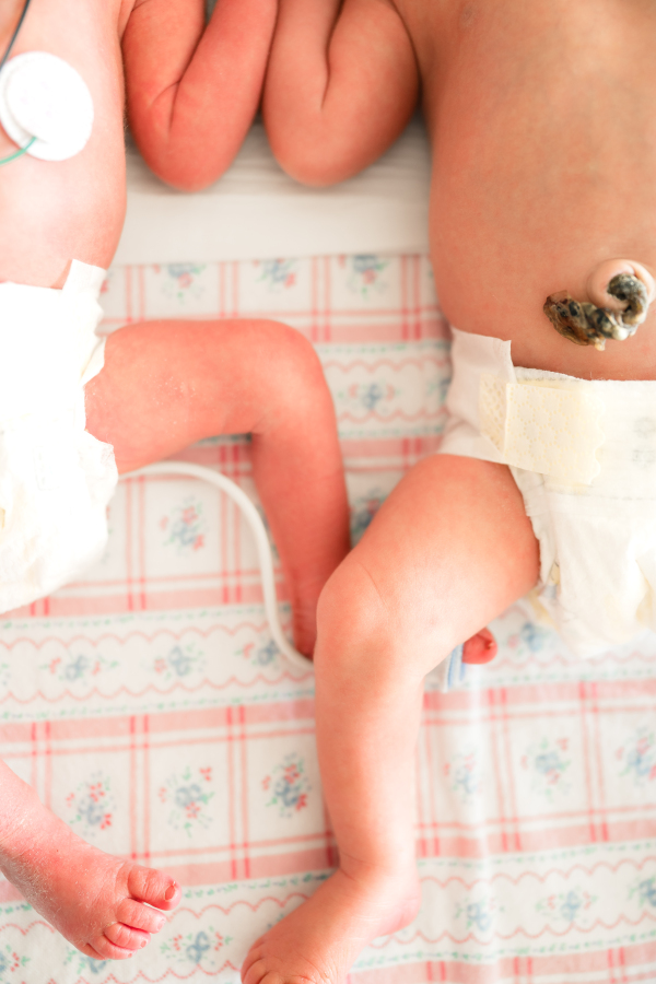 A close-up of twin girls during a newborn photoshoot at houston methodist the woodlands tx